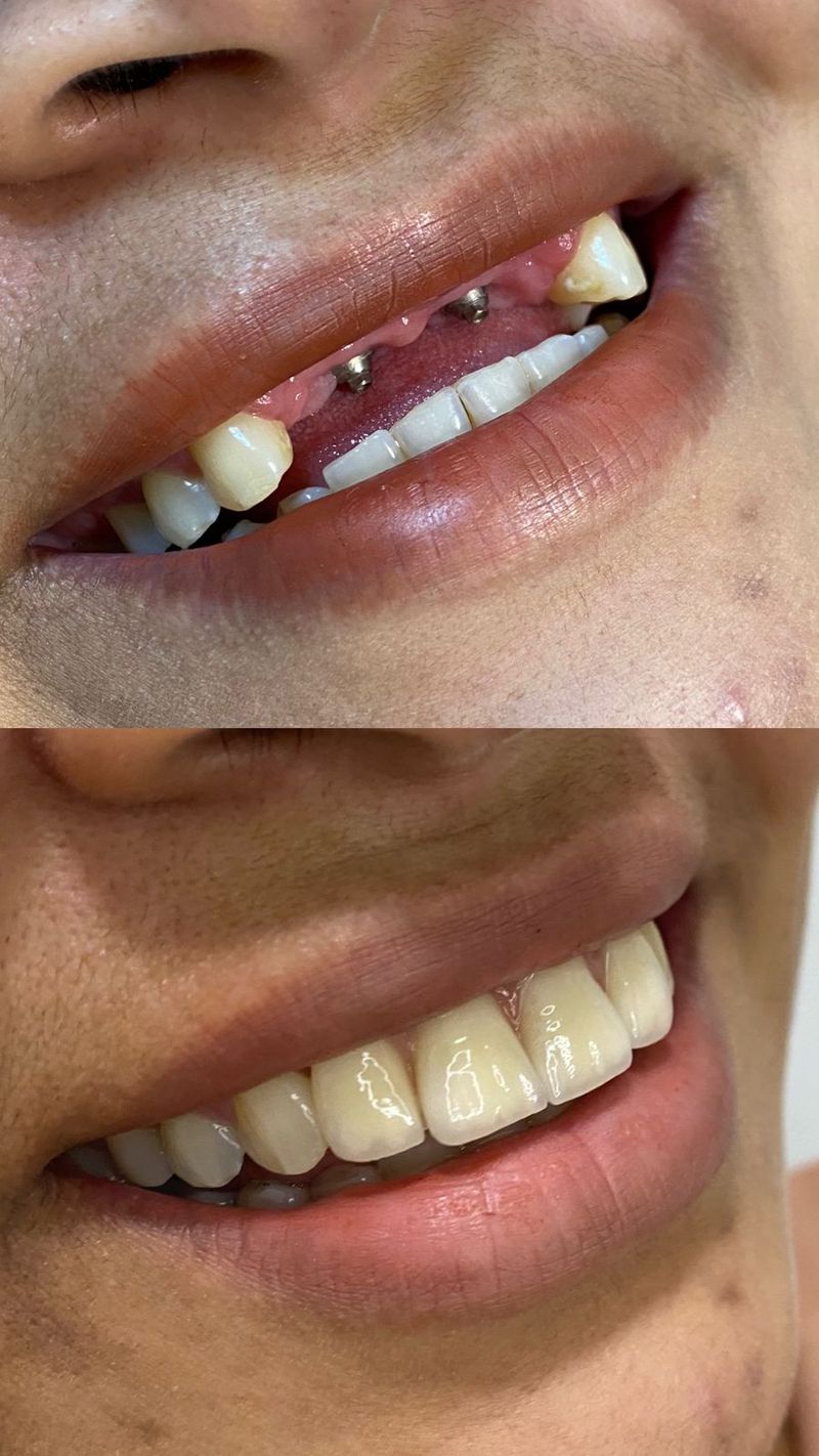 Depoimento de paciente da Oral Unic Timbó